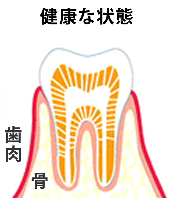 健康な状態