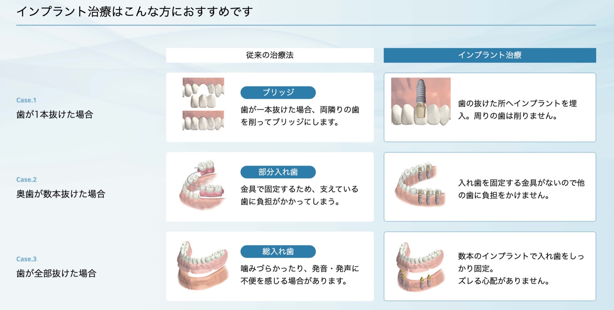 従来の治療法とインプラント治療法